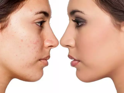Cosmetic and Minor Surgical Procedures Cosmetic and Minor Surgical Procedures